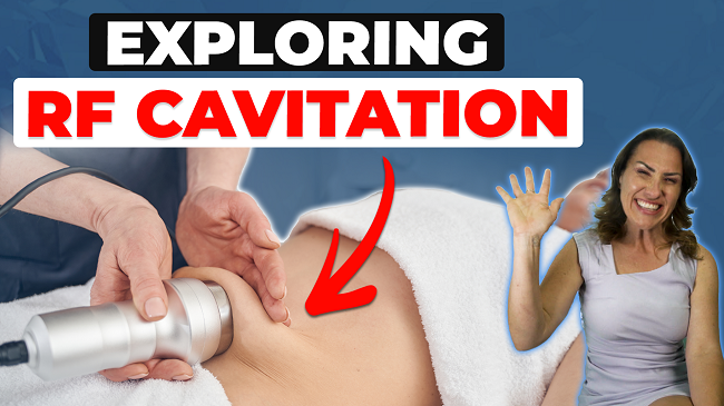 Exploring RF Cavitation featured image