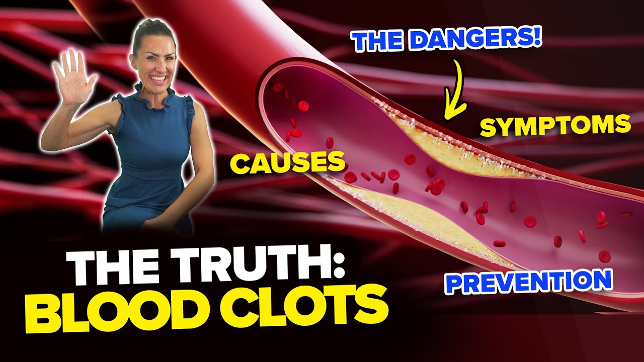 Featured Image The Truth About Blood Clots