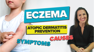 Eczema Featured Image